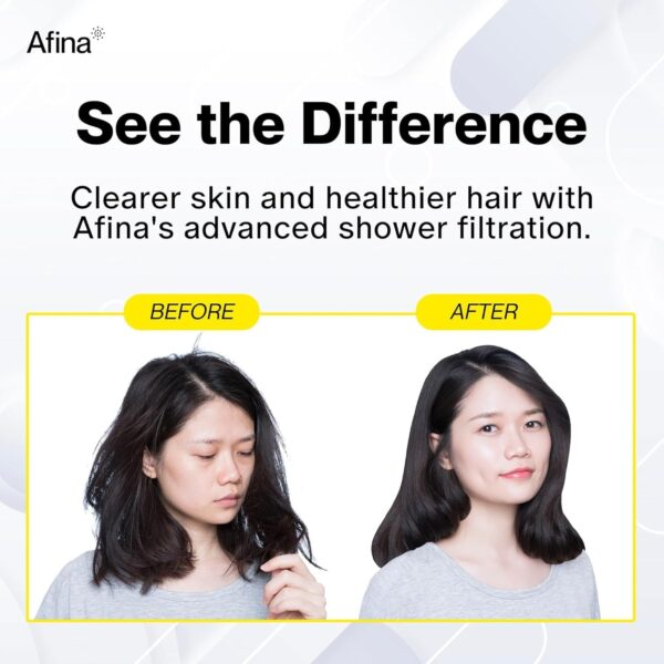 High Pressure Filtered Shower Head – Advanced Filtration for Hair, Skin & Nails – Reduces Itchiness, Blemishes, Dryness – Easy Install & Universal Fit with Long-Lasting Filters (Chrome)