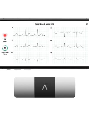KardiaMobile 6L Personal EKG Monitor with Most Smartphones