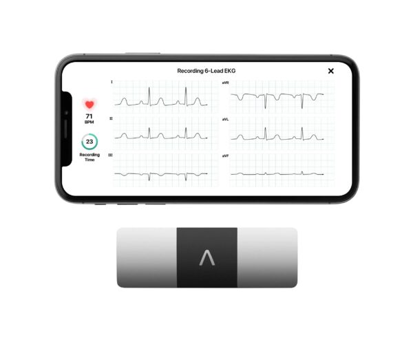 d7ecd86f5dba46598b88c06b8eda5872 KardiaMobile 6L Personal EKG Monitor with Most Smartphones