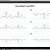 KardiaMobile 6L Personal EKG Monitor with Most Smartphones